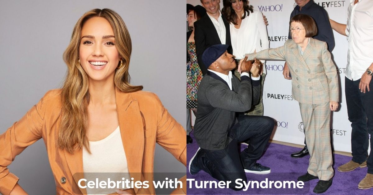 12 Famous People and Celebrities with Turner Syndrome